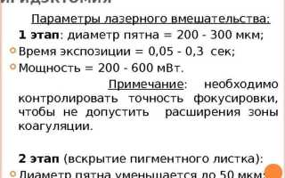 Иридэктомия: лазерная операция при глаукоме и восстановление в послеоперационный период для здоровья глаз