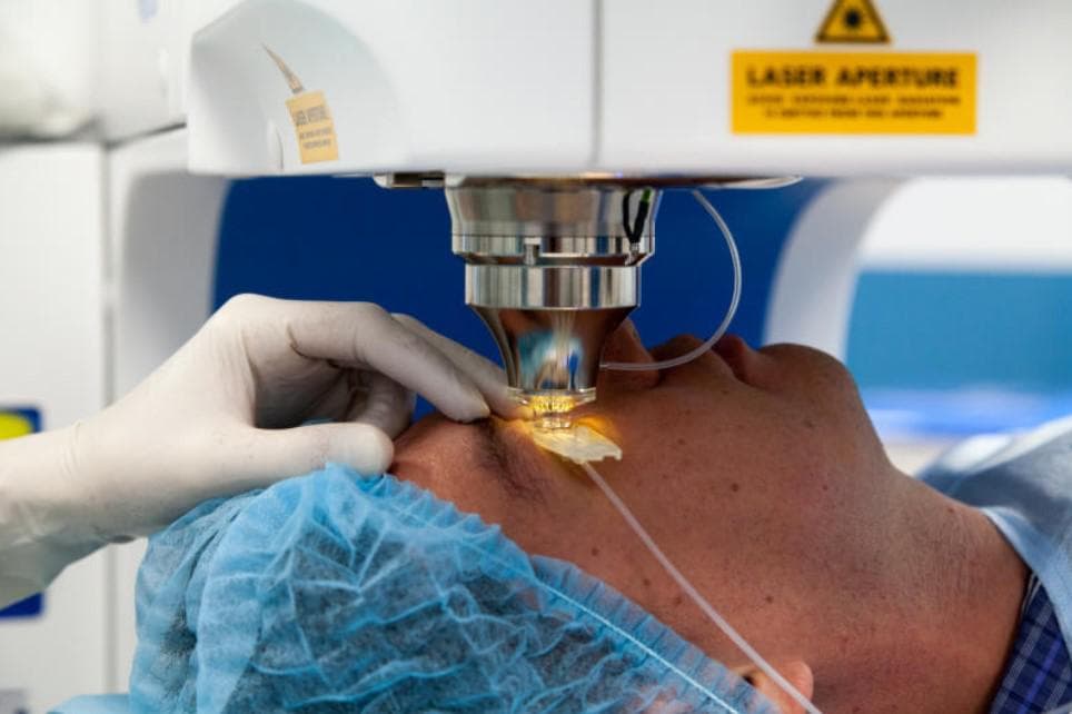 Лазерная операция для лечения астигматизма
