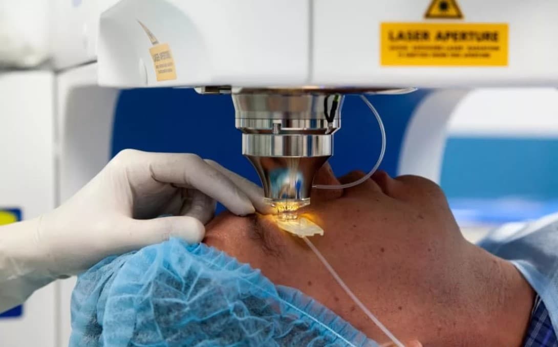 Лазерная операция на глаза