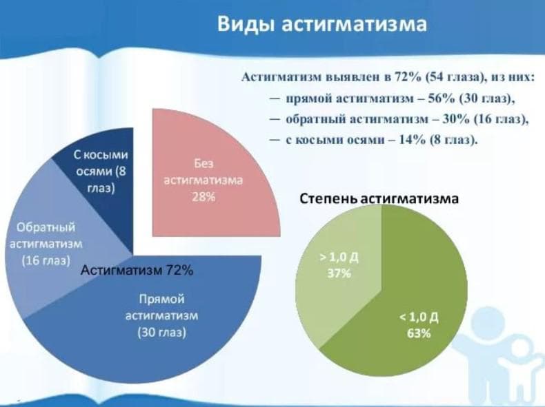 Распространение по видам астигматизма